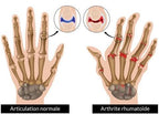 Mitaines de Compression Antidouleurs Arthrose